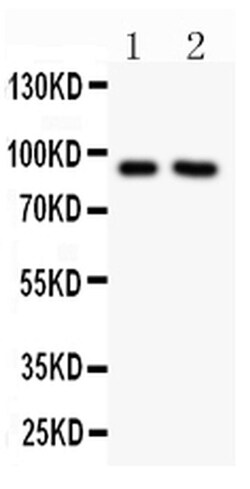 Invitrogen Nhe-1 Polyclonal Antibody 100 &mu;g; Unconjugated:Antibodies,