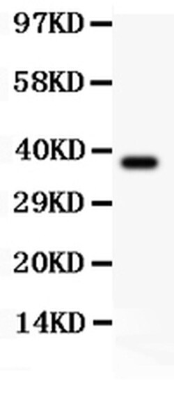 Invitrogen Nhe-1 Polyclonal Antibody 100 &mu;g; Unconjugated:Antibodies,