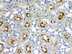 Invitrogen SMC3 Polyclonal Antibody 100 &mu;g; Unconjugated:Antibodies,
