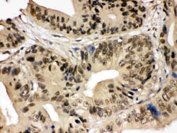 Invitrogen SMC3 Polyclonal Antibody 100 &mu;g; Unconjugated:Antibodies,