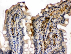 Invitrogen SMC3 Polyclonal Antibody 100 &mu;g; Unconjugated:Antibodies,