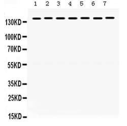 Invitrogen SMC3 Polyclonal Antibody 100 &mu;g; Unconjugated:Antibodies,