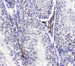 Invitrogen SMC6 Polyclonal Antibody 100 &mu;g | Buy Online | Invitrogen&trade; | Fisher Scientific