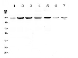 Invitrogen SMC6 Polyclonal Antibody 100 &mu;g | Buy Online | Invitrogen&trade; | Fisher Scientific
