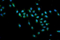 Invitrogen SMN1/SMN2 Polyclonal Antibody 100 &mu;g | Buy Online | Invitrogen&trade; | Fisher Scientific