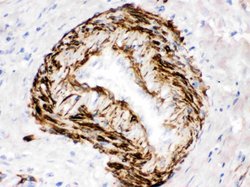 Invitrogen SMYD3 Polyclonal Antibody 100 &mu;g; Unconjugated:Antibodies,