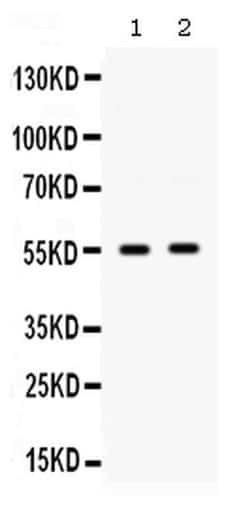 Invitrogen SMYD3 Polyclonal Antibody 100 &mu;g; Unconjugated:Antibodies,