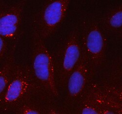 Invitrogen SOD2 (MnSOD) Polyclonal Antibody 100 &mu;g; Unconjugated:Antikörper