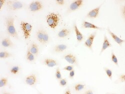 Invitrogen SOD2 (MnSOD) Polyclonal Antibody 100 &mu;g; Unconjugated:Antibodies,