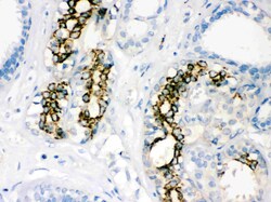 Invitrogen SOD2 (MnSOD) Polyclonal Antibody 100 &mu;g; Unconjugated:Antibodies,