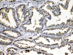 Invitrogen SOD3 Polyclonal Antibody 100 &mu;g | Buy Online | Invitrogen&trade; | Fisher Scientific