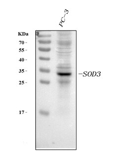 Invitrogen SOD3 Polyclonal Antibody 100 &mu;g | Buy Online | Invitrogen&trade; | Fisher Scientific