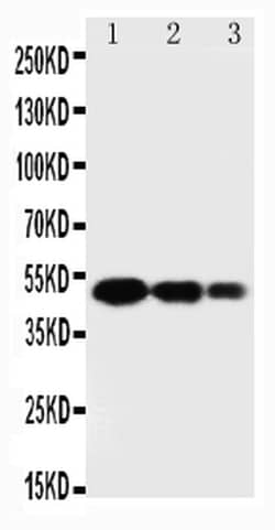 Invitrogen SPARC Polyclonal Antibody 100 &mu;g; Unconjugated:Antibodies,