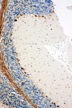 Invitrogen SSR3 Polyclonal Antibody 100 &mu;g; Unconjugated:Antibodies,