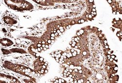 Invitrogen SSR3 Polyclonal Antibody 100 &mu;g; Unconjugated:Antibodies,