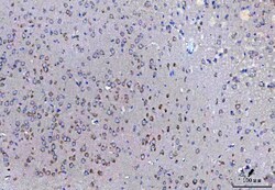 Invitrogen SSR3 Polyclonal Antibody 100 &mu;g; Unconjugated:Antibodies,