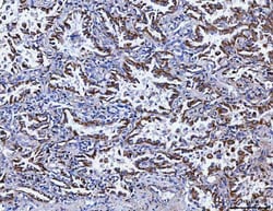 Invitrogen SSR3 Polyclonal Antibody 100 &mu;g; Unconjugated:Antibodies,
