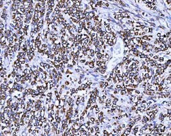 Invitrogen SSR3 Polyclonal Antibody 100 &mu;g; Unconjugated:Antibodies,