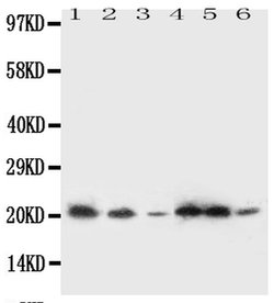 Invitrogen SSR3 Polyclonal Antibody 100 &mu;g; Unconjugated:Antibodies,