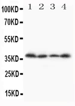 Invitrogen™ STRA8 Polyclonal Antibody