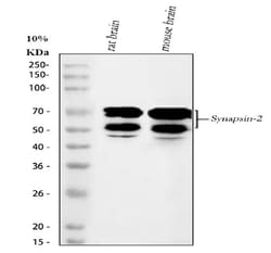 Invitrogen Synapsin II Polyclonal Antibody 100 &mu;g; Unconjugated:Antibodies,