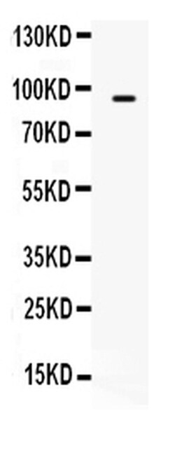 Invitrogen TAP2 Polyclonal Antibody 100 &mu;g; Unconjugated:Antibodies,