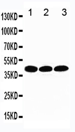 Invitrogen TBP Polyclonal Antibody 100 &mu;g; Unconjugated:Antibodies,