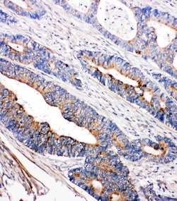 Invitrogen TEC Polyclonal Antibody 100 &mu;g; Unconjugated:Antibodies,