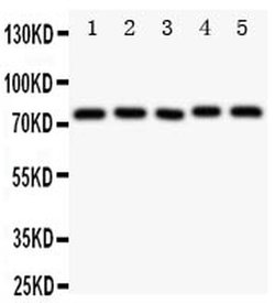 Invitrogen TEC Polyclonal Antibody 100 &mu;g; Unconjugated:Antibodies,