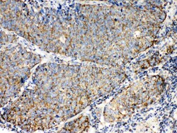 Invitrogen TECTA Polyclonal Antibody 100 &mu;g; Unconjugated:Antibodies,