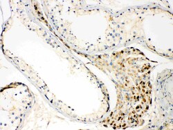 Invitrogen TECTA Polyclonal Antibody 100 &mu;g; Unconjugated:Antibodies,