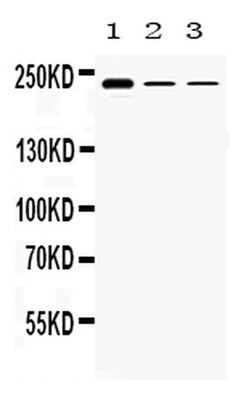 Invitrogen TECTA Polyclonal Antibody 100 &mu;g; Unconjugated:Antibodies,
