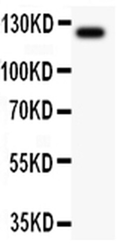 Invitrogen TIE2 (TEK) Polyclonal Antibody 100 &mu;g; Unconjugated:Antibodies,
