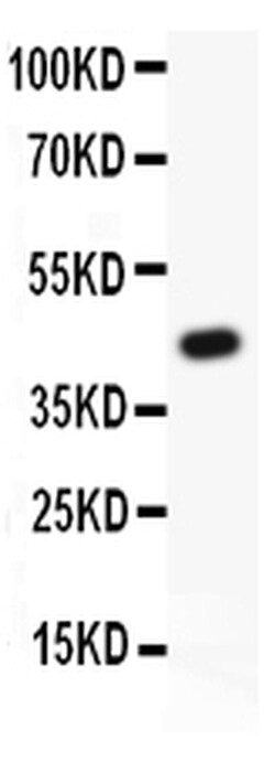 Invitrogen TIE2 (TEK) Polyclonal Antibody 100 &mu;g; Unconjugated:Antibodies,