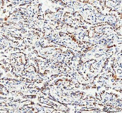 Invitrogen TFAM Polyclonal Antibody 100 &mu;g; Unconjugated:Antibodies,