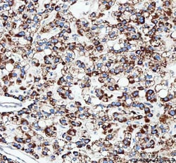 Invitrogen TFAM Polyclonal Antibody 100 &mu;g; Unconjugated:Antibodies,