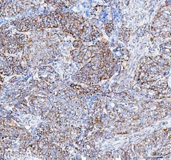 Invitrogen TFAM Polyclonal Antibody 100 &mu;g; Unconjugated:Antibodies,