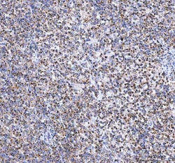 Invitrogen TFAM Polyclonal Antibody 100 &mu;g; Unconjugated:Antibodies,