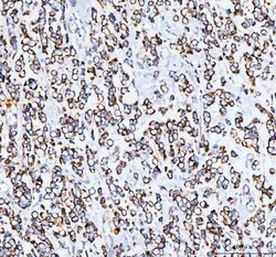 Invitrogen TFAM Polyclonal Antibody 100 &mu;g; Unconjugated:Antibodies,