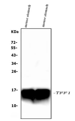 Invitrogen TFF1 Polyclonal Antibody 100 &mu;g | Buy Online | Invitrogen&trade; | Fisher Scientific