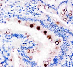 Invitrogen TFF1 Polyclonal Antibody 100 &mu;g; Unconjugated:Antibodies,