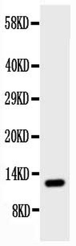 Invitrogen TFF1 Polyclonal Antibody 100 &mu;g; Unconjugated:Antibodies,