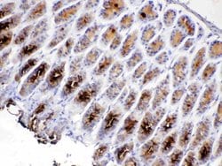 Invitrogen TFF2 Polyclonal Antibody 100 &mu;g; Unconjugated:Antibodies,