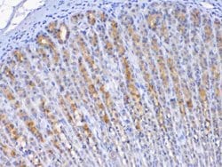 Invitrogen TFF2 Polyclonal Antibody 100 &mu;g; Unconjugated:Antibodies,