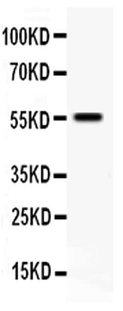 Invitrogen TFPI Polyclonal Antibody 100 &mu;g; Unconjugated:Antibodies,