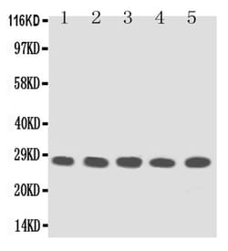Invitrogen TFPI2 Polyclonal Antibody 100 &mu;g; Unconjugated:Antibodies,