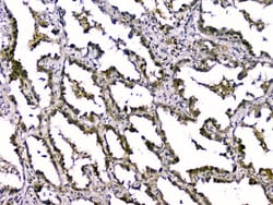 Invitrogen TGF beta-2 Polyclonal Antibody 100 &mu;g; Unconjugated:Antibodies,