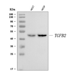 Invitrogen TGF beta-2 Polyclonal Antibody 100 &mu;g; Unconjugated:Antibodies,