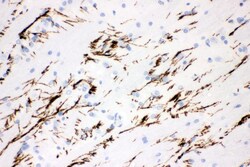 Invitrogen Tyrosine Hydroxylase Polyclonal Antibody 100 &mu;g | Buy Online | Invitrogen&trade; | Fisher Scientific