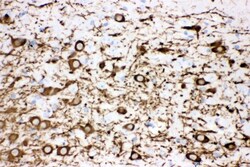 Invitrogen Tyrosine Hydroxylase Polyclonal Antibody 100 &mu;g | Buy Online | Invitrogen&trade; | Fisher Scientific